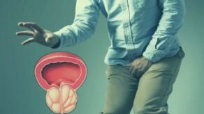 Oxygical prostatitis